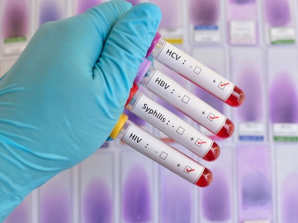 A gloved hand holding four labeled blood test vials for HCV, HBV, Syphilis, and HIV. Each vial has checkboxes for negative and positive results, with the positive box checked in red on all four.