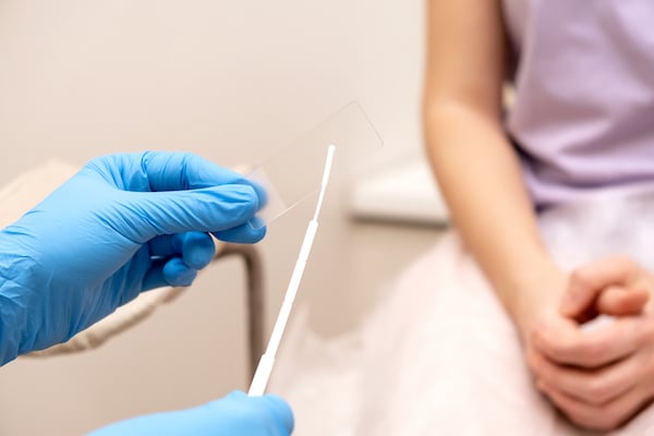 The gynecologist puts a smear on a slide glass for microscopy, hands close-up - How to Swab for Gonorrhea and Chlamydia