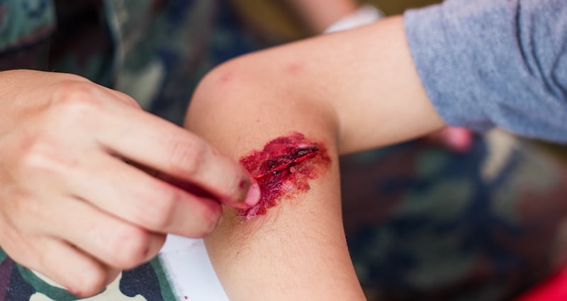 How to Measure a Wound: A Comprehensive Guide