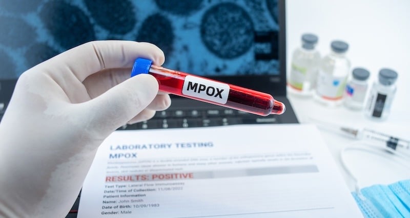 How to Swab for Mpox (Monkeypox)