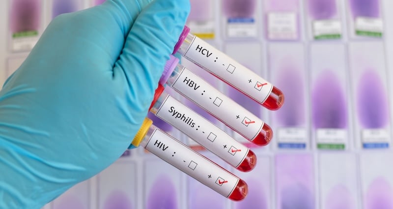 The Ideal STI Swab for Testing Needs
