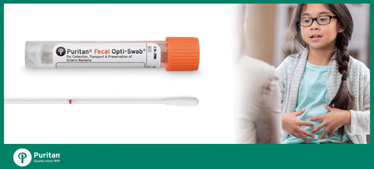 Fecal Swabs: What to Look for in a Fecal Swab Test Kit
